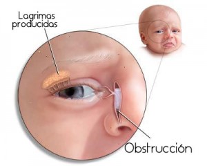 Ojo Lloroso en Niños