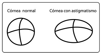 Errores Refractivos